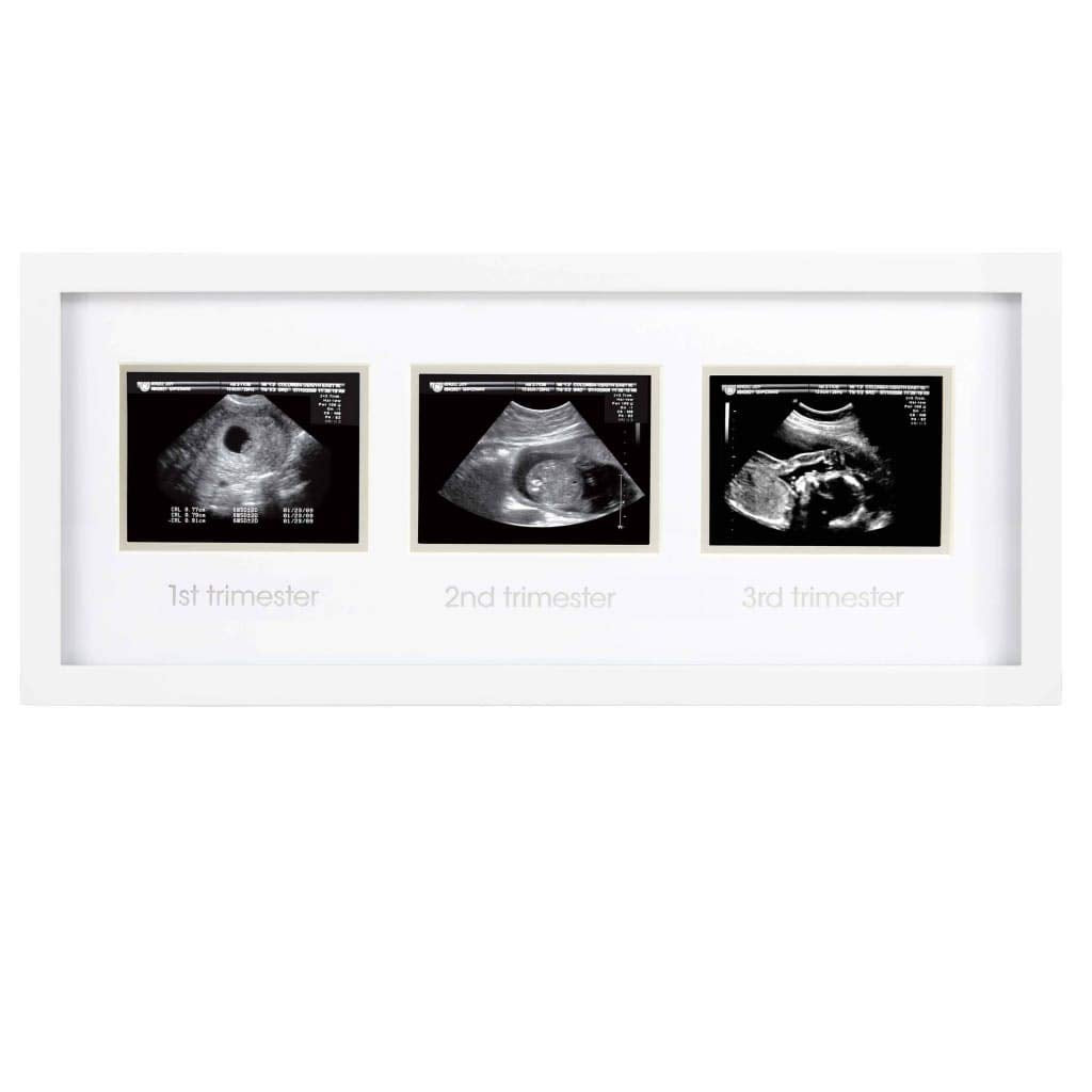 Pearhead ultrahelipiltide raam „Triple Sonogram“, valge