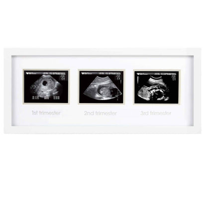 Pearhead ultrahelipiltide raam „Triple Sonogram“, valge