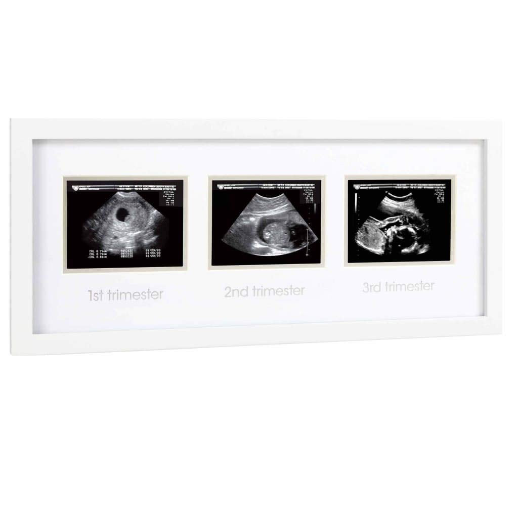 Pearhead ultrahelipiltide raam „Triple Sonogram“, valge