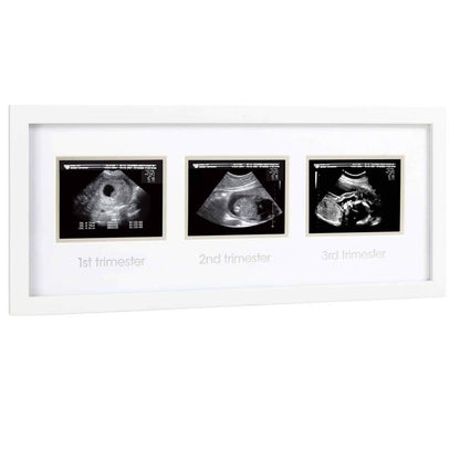 Pearhead ultrahelipiltide raam „Triple Sonogram“, valge