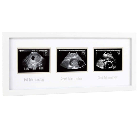 Pearhead ultrahelipiltide raam „Triple Sonogram“, valge