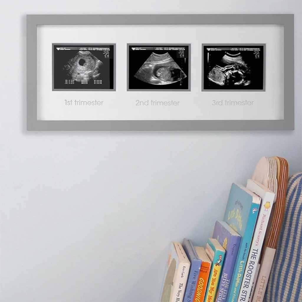 Pearhead ultrahelipiltide raam „Triple Sonogram“, valge